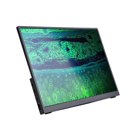 fotocamera per microscopio trinoculare | microscopio digitale | microscopio con telecamera leica